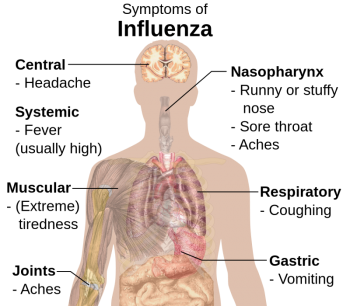 Diagram of flu symptoms